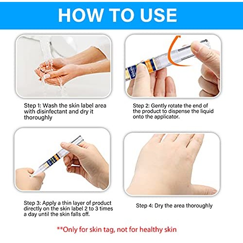 Skin Tag Remover, Extra Strength Skin tag Removal, Wart Remover, Tag Dry and ...