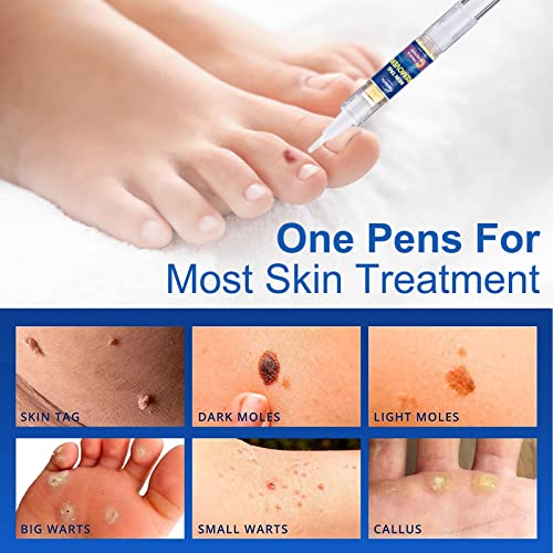 Skin Tag Remover, Wart Remover, Extra Strength Skin tag Removal, Tag Dry and ...