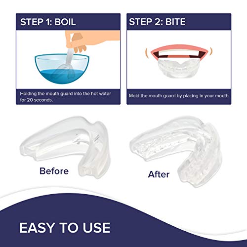 Serenity Bruxism Night Sleep Aid Mouthpiece Boil and Bite Guard