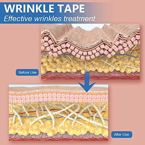Wrinkle Patches - Face Eye Neck Lift Tape - Anti Wrinkle Tape - Multifunction...