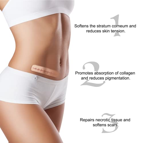 Silicone Scar Sheets(1.6'' x 60''), Medical Grade Scar Tape, Reusable Silicon...