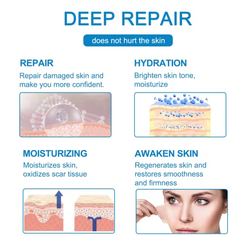 Silicone Scar Sheets(1.6'' x 60''), Medical Grade Scar Tape, Reusable Silicon...