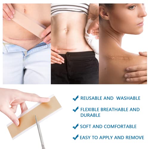 Silicone Scar Tape, Strips, Sheets (1.6” x 60”), Silicone Scar Tape Roll - So...