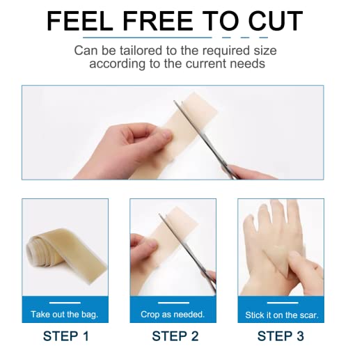 Silicone Scar Tape, Strips, Sheets (1.6” x 60”), Silicone Scar Tape Roll - So...