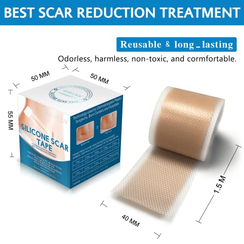Silicone Scar Tape, Strips, Sheets (1.6” x 60”), Silicone Scar Tape Roll - So...