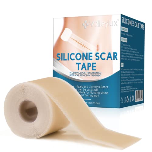 Silicone Scar Tape, Strips, Sheets (1.6” x 60”), Silicone Scar Tape Roll - So...