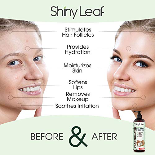 Fractionated Coconut Oil, 100% Pure & Natural Body Oil for Massage & Aromathe...