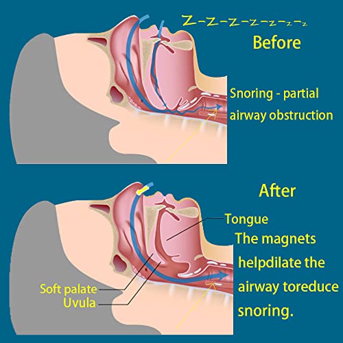 SHIXUAN 12 PCS Anti Snoring Device - Silicon Magnetic Anti Snoring Nose Clip,...