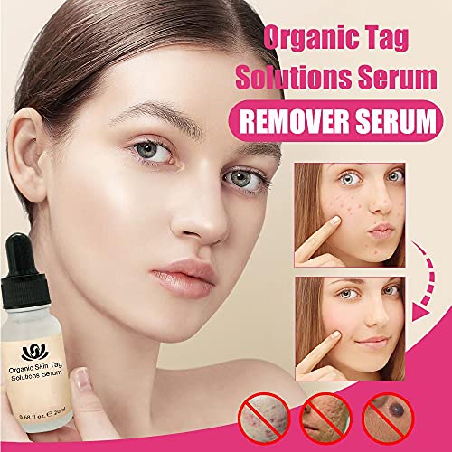 Organic Skin Tag Solution Serum Remover, Mole and Skin Tag Remover Dark Spot ...