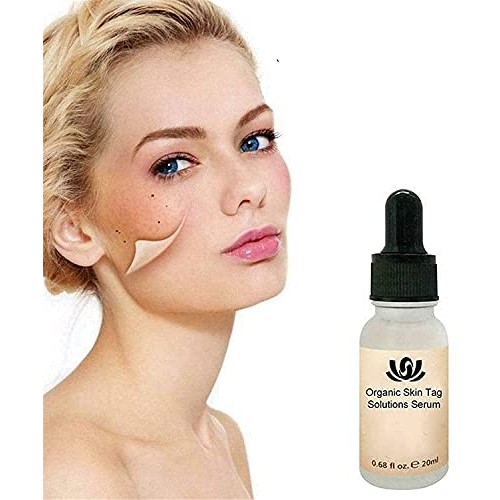 Organic Skin Tag Solution Serum Remover, Mole and Skin Tag Remover Dark Spot ...