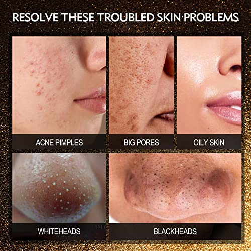 Blackhead Remover Mask, 3-in-1 Peel off Face Mask with 24K Gold Serum & Silic...