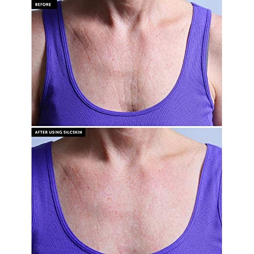 SilcSkin Decollette Pad to Correct & Prevent Chest Wrinkles from Sun, Aging, ...