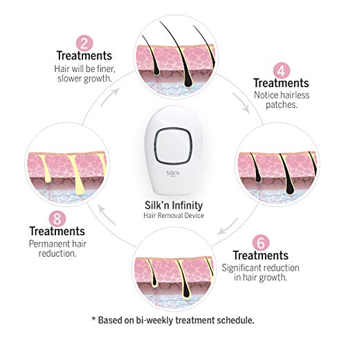 Silk’n Infinity - At Home Permanent Hair Removal for Women and Men, Lifetime ...