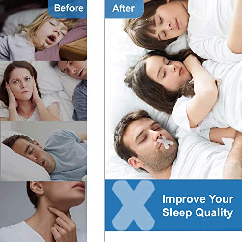 120 Pcs Sleep Strips,Anti Snoring Devices Advanced Gentle Mouth Tape for Slee...