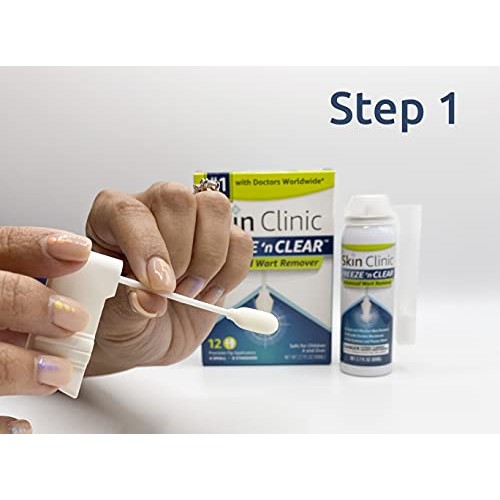 Skin Clinic FREEZE ‘n CLEAR™ Advanced Wart Remover, #1 Wart Removal Technolog...