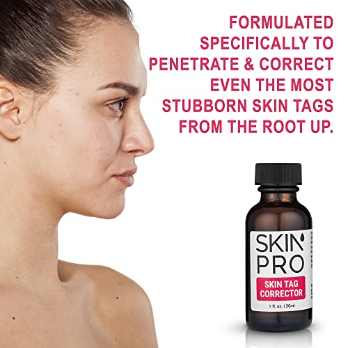 SkinPro Skin Tag Corrector & Mole Removal Cream - Fast Acting Industry Leadin...
