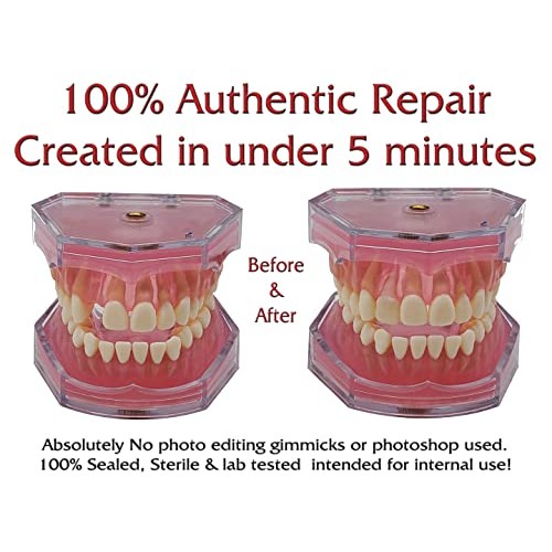 SmileFix Standard Color Matching Dental Repair Kit – Hide & Fix Smile with mi...