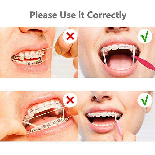 300 Pcs SmileTech Dental Brace Bands 3/16 Neon Medium 3.5 OZ Dental Teeth Gap...