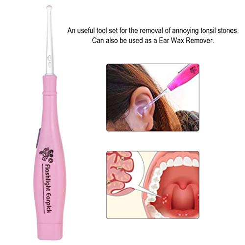 Soapow Tonsil Stone Remover Tool LED Earwax Removal Stainless Steel Remover w...