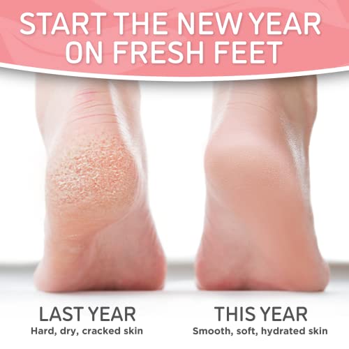 Soft Touch Foot Peel Mask - Pack of 2 Feet Peeling Masks for Dry, Cracked Hee...