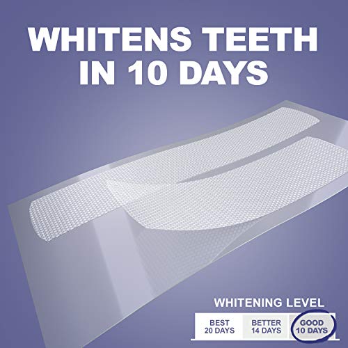 Amazon Brand - Solimo 10 Day Teeth Whitening Strips Kit, 10 Treatments