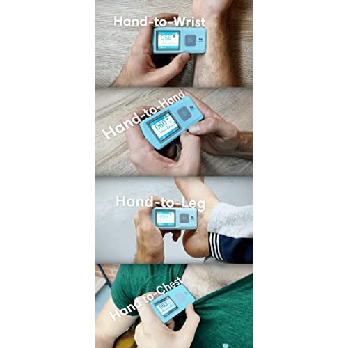 SonoHealth Portable EKG Heart Rate Monitor | Wireless Handheld Home ECG Cardi...