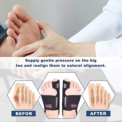 Bunion Corrector for Women Men, Bunion Relief Bunion Splint Big Toe Bunion Co...