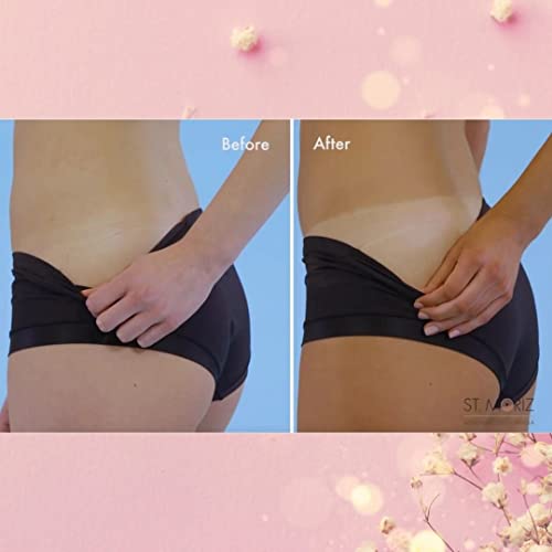 St. Moriz Professional Self-Tanning Mousse and Applicator Mitt Set - Medium -...