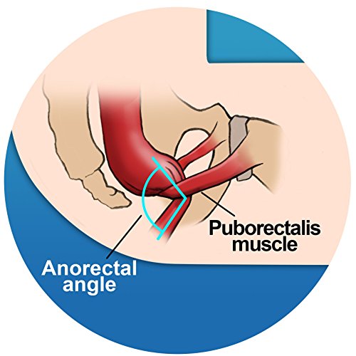 Step and Go LLC Toilet Stool 7” New - Proper Toilet Posture for Better and He...