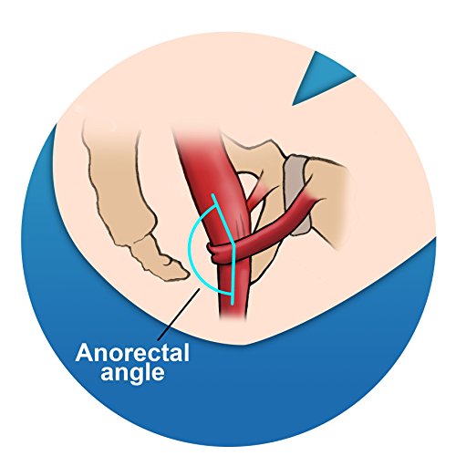 Step and Go LLC Toilet Stool 7” New - Proper Toilet Posture for Better and He...