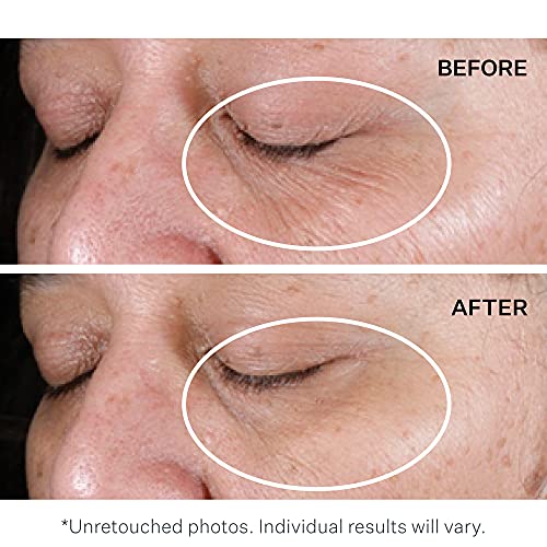 StriVectin Anti-Wrinkle High-Potency Wrinkle Filler Cream, Targets Expression...