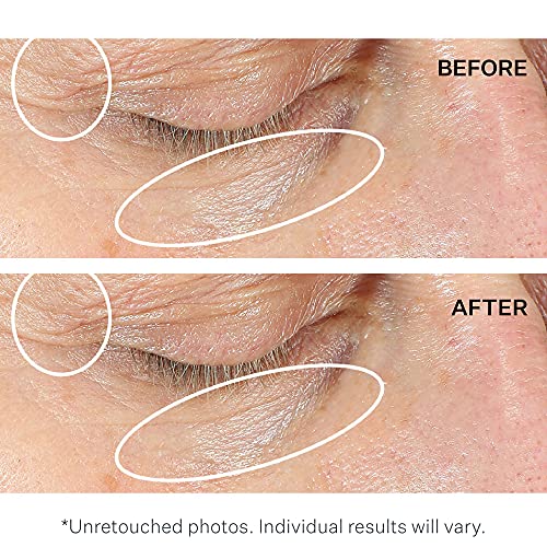 StriVectin Anti-Wrinkle Intensive Eye Cream Concentrate for Wrinkles PLUS, Ta...