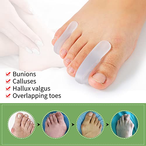 Toe Separators for Overlapping Toes, 12Pieces Silicone Toe Corrector for Wome...