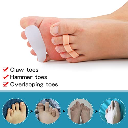 Toe Separators for Overlapping Toes, 6Pieces Silicone Toe Corrector Dividers ...