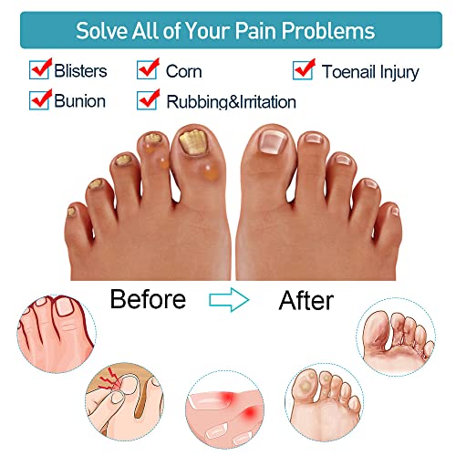 Sumiwish Gel Toe Corrector, 12 PCS Gel Toe Separators, Toe Spacer with 2 Loop...