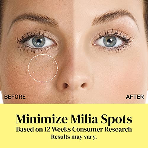 Milia Remover Milia Spot Treatment Helps Dissolve and Reduce Milia in 4 weeks...