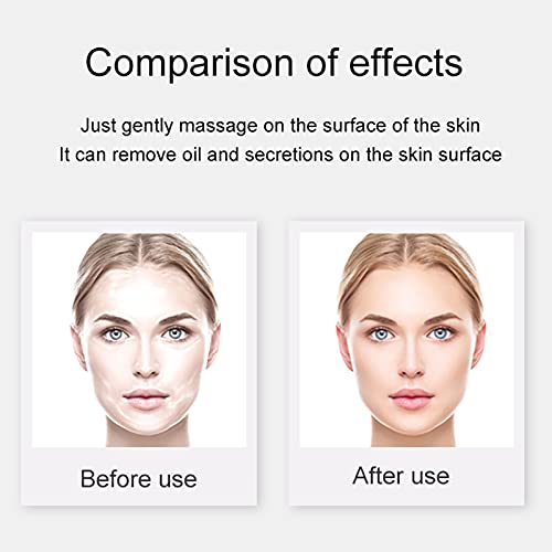 Oil-Absorbing Volcanic Face Roller,Instant Results Remove Excess Shine Rollin...