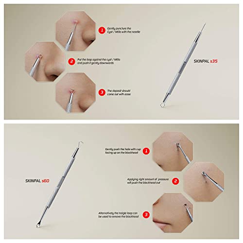 Suvorna Skinpal S100 Pimple Popper tool Kit. Lancet for Facial Milia Remover....