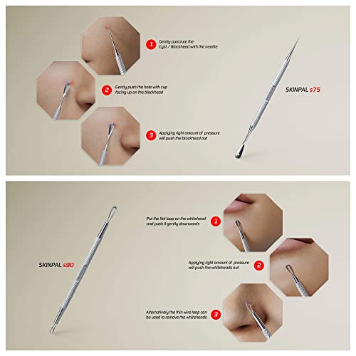 Suvorna Skinpal S100 Pimple Popper tool Kit. Lancet for Facial Milia Remover....