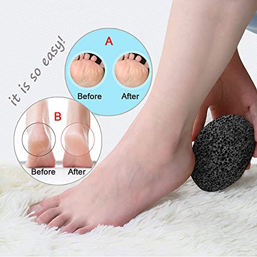 Symlis Natural Pumice Stone for Feet - Lava Callus Remover Feet - Health Foot...