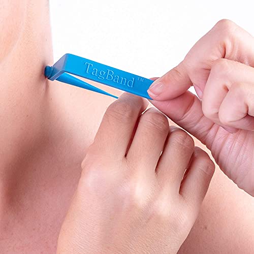 Micro TagBand- Skin Tag Remover Device for Small to Medium Size Skin Tags (in...