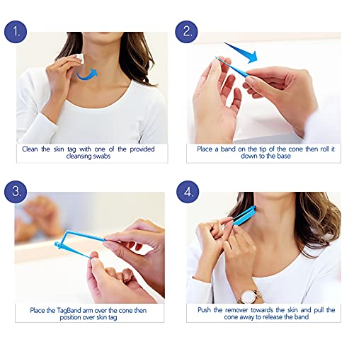 Micro TagBand- Skin Tag Remover Device for Small to Medium Size Skin Tags (in...