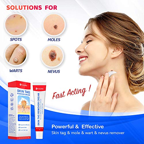Skin Tag Remover, Warts Remover Cream,Quickly and Easily Remove Common Skin T...