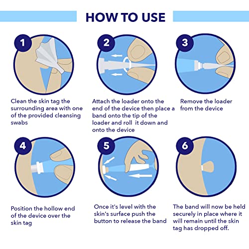 TAGRID Skin Tag Remover, Skin Tag Remover Device for Small to Medium (2mm -5m...