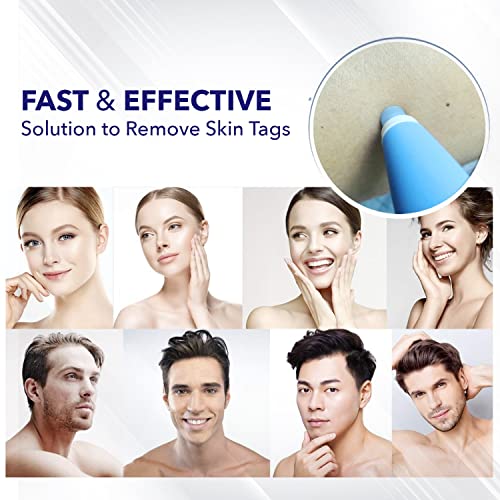TAGRID Skin Tag Remover, Skin Tag Remover Device for Small to Medium (2mm -5m...