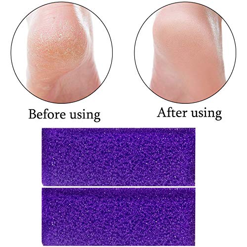 40 Pcs Pumice Stone for Feet Foot Scrubber Sponge for Feet Care and Callus Re...