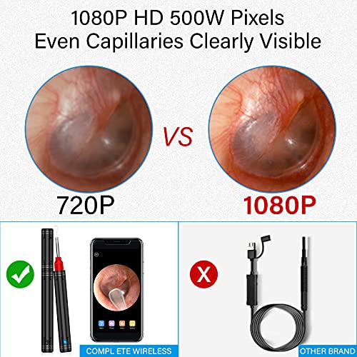 Ear Wax Removal Ear Cleaner Ear Wax Candles with 1080P FHD Camera Earwax Remo...