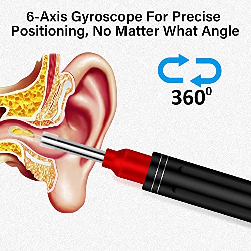 Ear Wax Removal Ear Cleaner Ear Wax Candles with 1080P FHD Camera Earwax Remo...