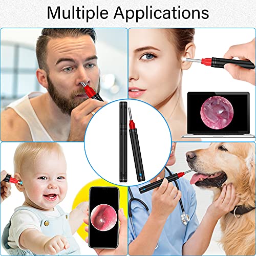 Ear Wax Removal Ear Cleaner Ear Wax Candles with 1080P FHD Camera Earwax Remo...