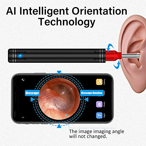 Ear Wax Removal Ear Cleaner Ear Wax Candles with 1080P FHD Camera Earwax Remo...